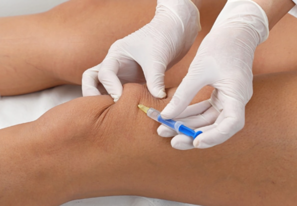 Mésothérapie/Infiltration