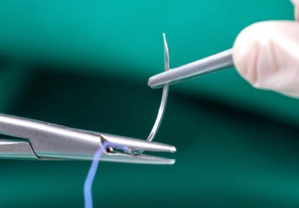 Ablations de sutures